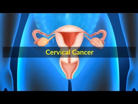 causes of cervical cancer pdf